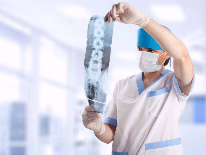 лекарят гледа снимка на шийния отдел на гръбначния стълб с остеохондроза