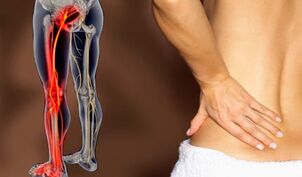 Характеристики на болки в гърба